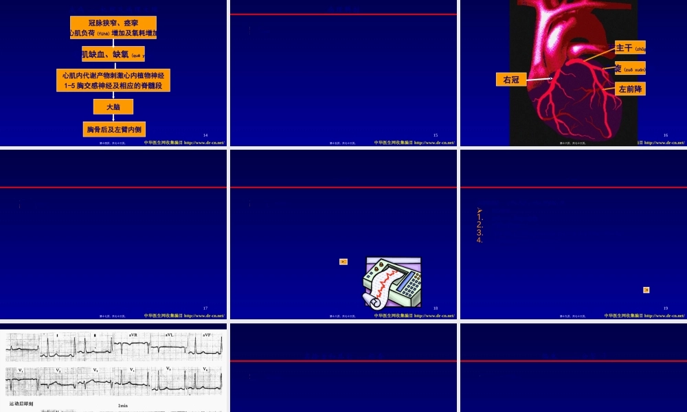 2022年医学专题—冠状动脉粥样硬化性心脏病-(2)(1).ppt