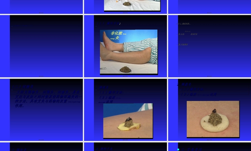 2022年医学专题—灸法和拔罐(1).ppt