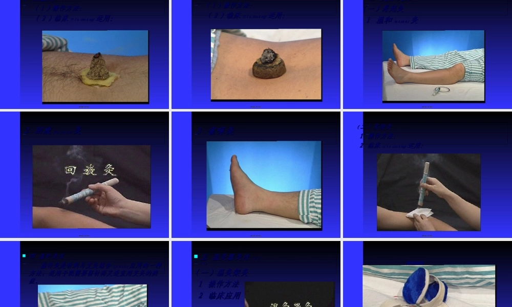 2022年医学专题—灸法和拔罐(1).ppt