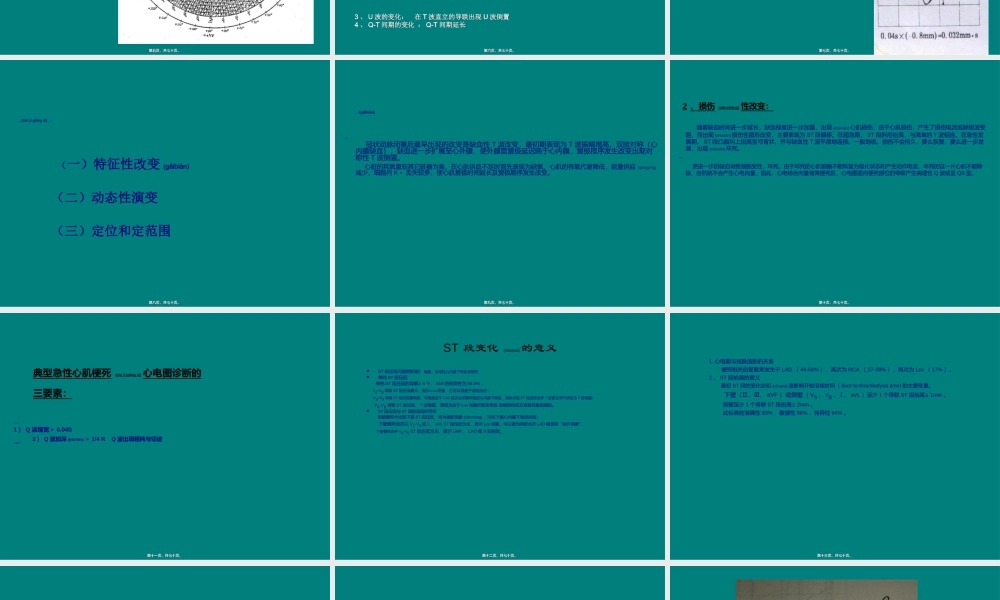 2022年医学专题—冠心病的心电图表现#.ppt