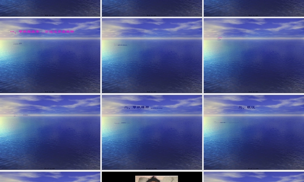 2022年医学专题—甲状腺功能亢进症(1)(1).ppt