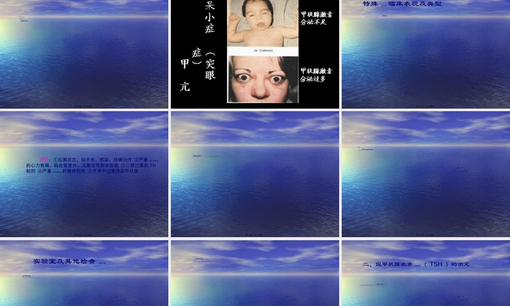 2022年医学专题—甲状腺功能亢进症(1)(1).ppt