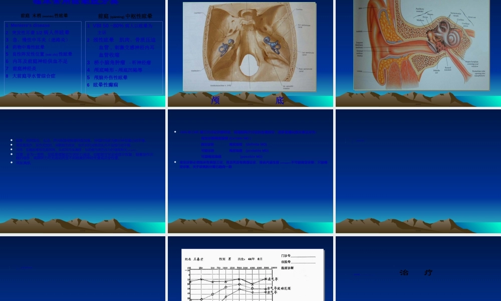 2022年医学专题—耳源性眩晕诊治(1).ppt