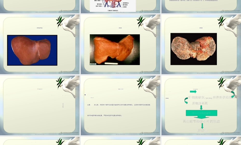 2022年医学专题—肝硬化zhouyan(1).ppt