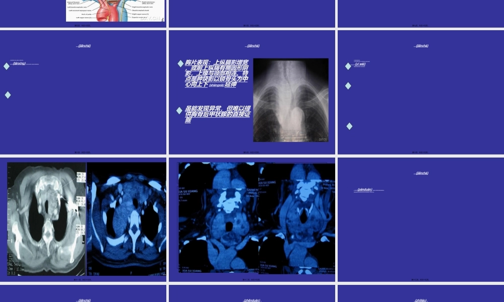 2022年医学专题—胸骨后甲状腺肿的外科处理(1).ppt