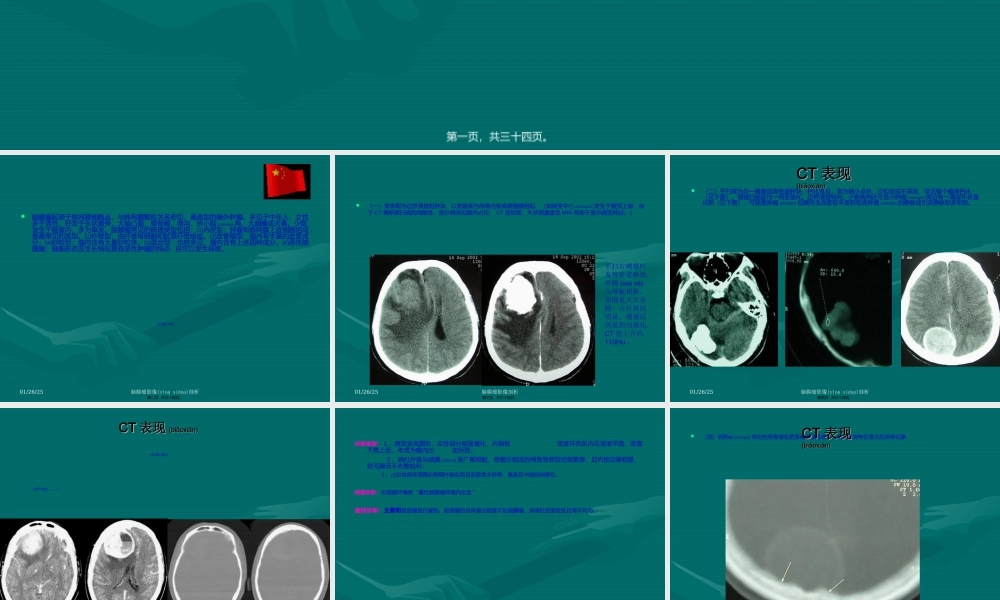 2022年医学专题—脑膜瘤CTMRI表现(1).ppt