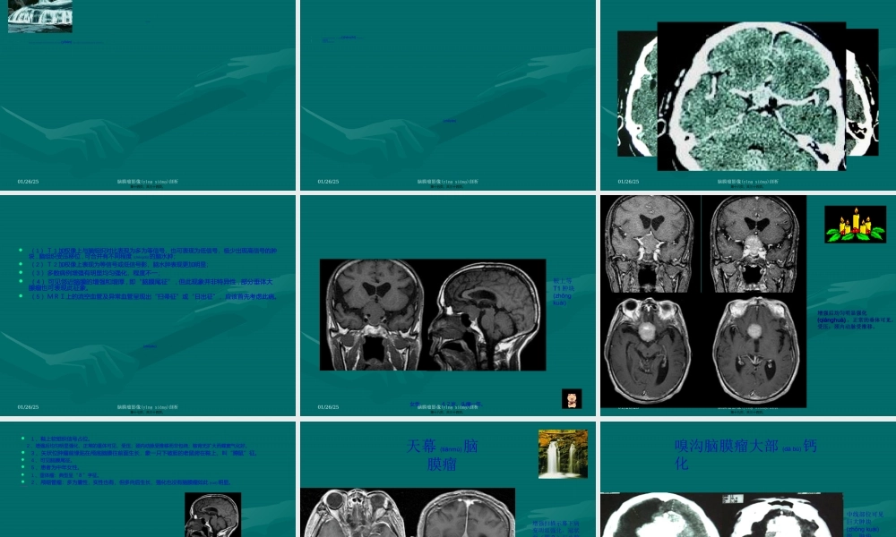 2022年医学专题—脑膜瘤CTMRI表现(1).ppt