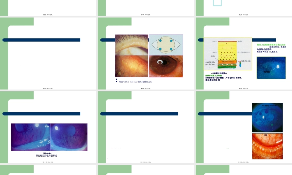 2022年医学专题—干眼症.ppt