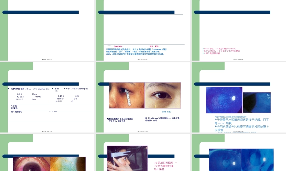 2022年医学专题—干眼症.ppt