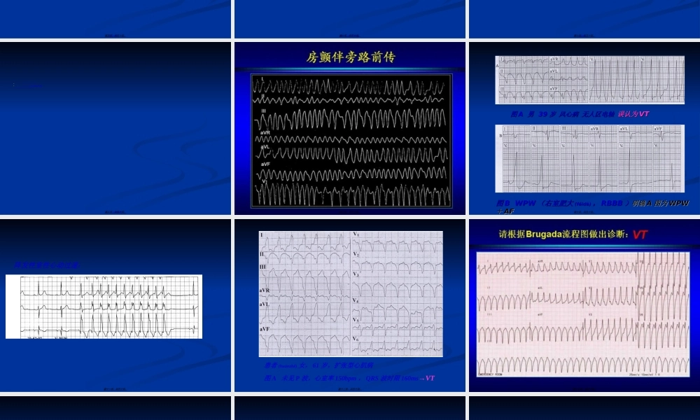 2022年医学专题—心律失常急诊处理新进展.ppt