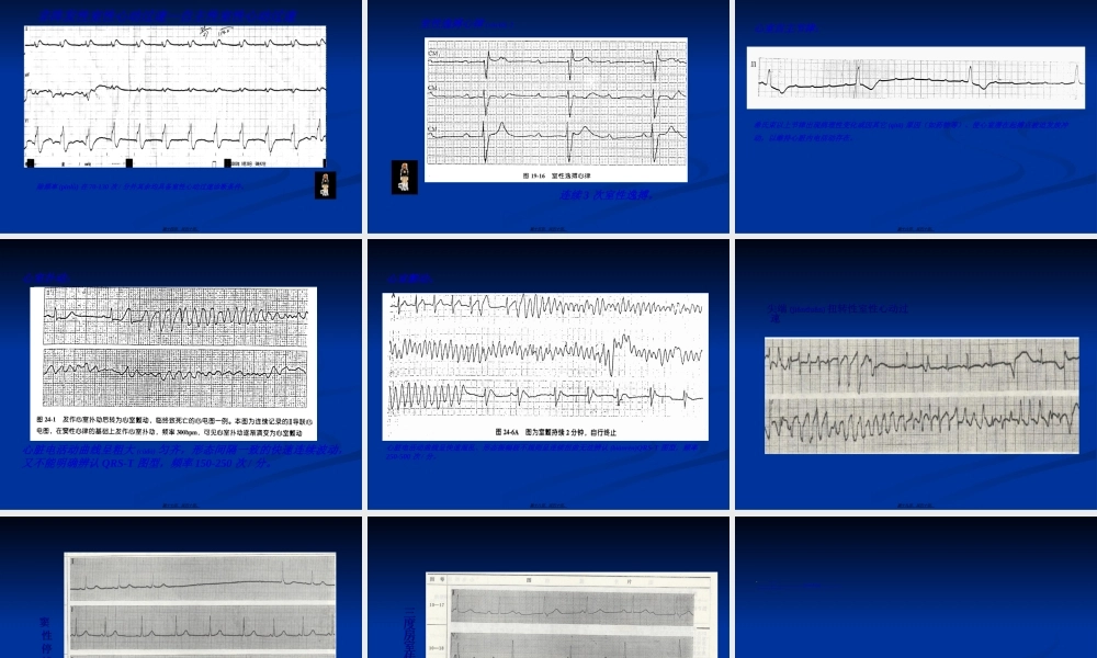 2022年医学专题—心律失常急诊处理新进展.ppt