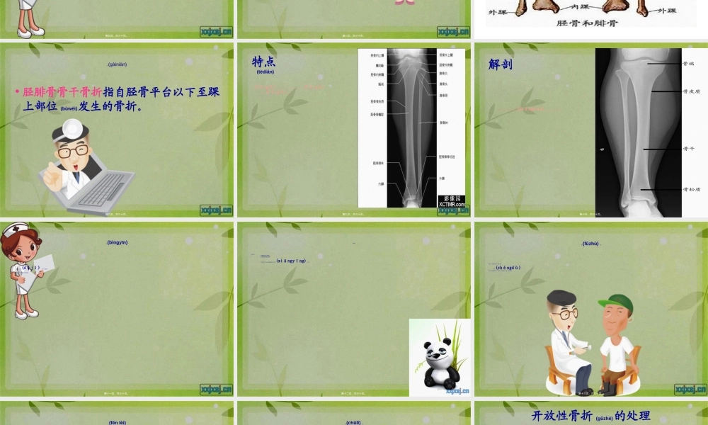 2022年医学专题—胫腓骨骨折.ppt
