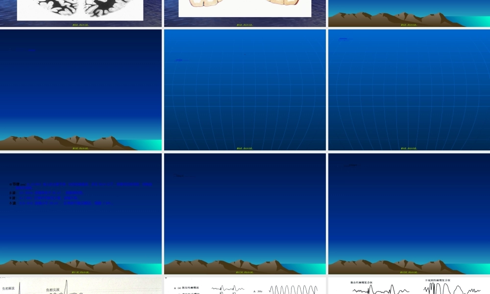 2022年医学专题—脑电图知识.ppt