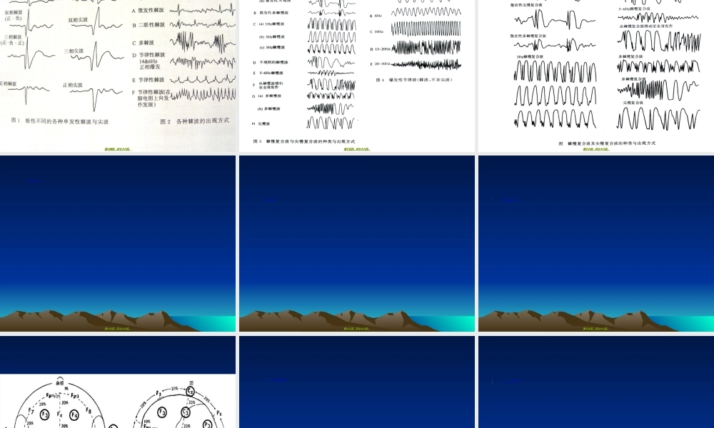 2022年医学专题—脑电图知识.ppt
