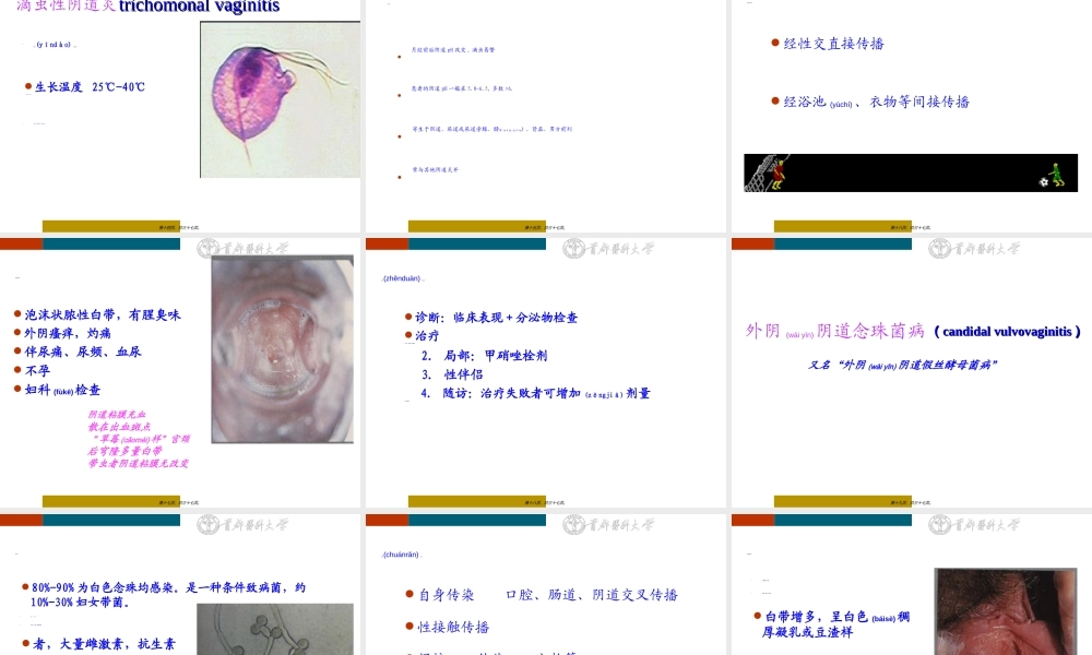 2022年医学专题—生殖道感染和性传播感染.ppt