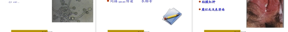 2022年医学专题—生殖道感染和性传播感染.ppt