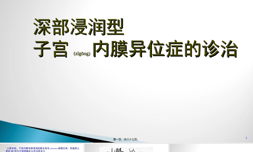 2022年医学专题—子宫内膜异位(1).ppt