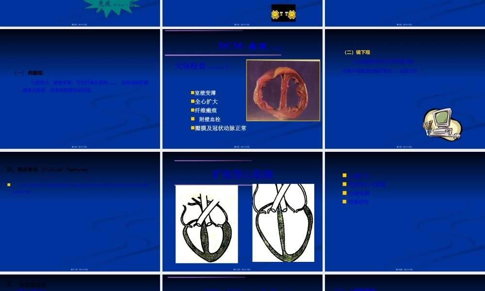 2022年医学专题—扩张型心肌病幻灯2(1).ppt