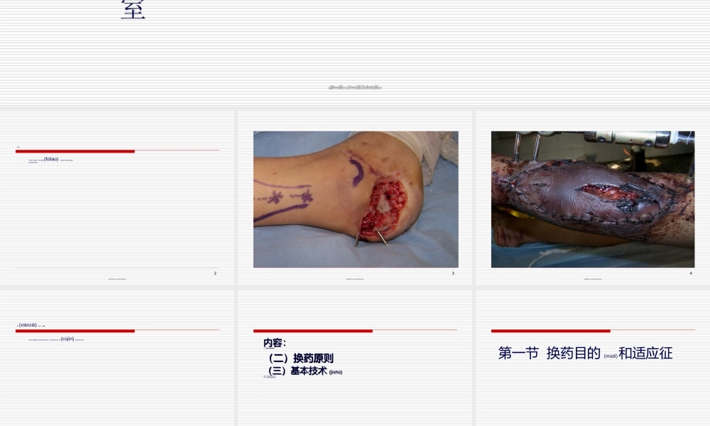 2022年医学专题—清创换药术-陈迎涛(1).ppt