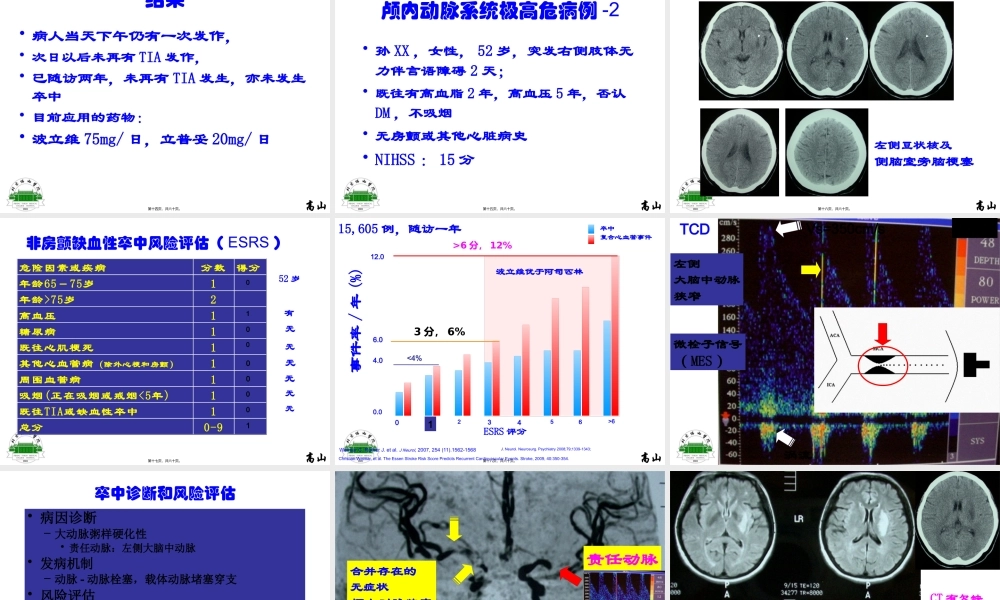 动脉粥样硬化性梗死分层病例.pptx