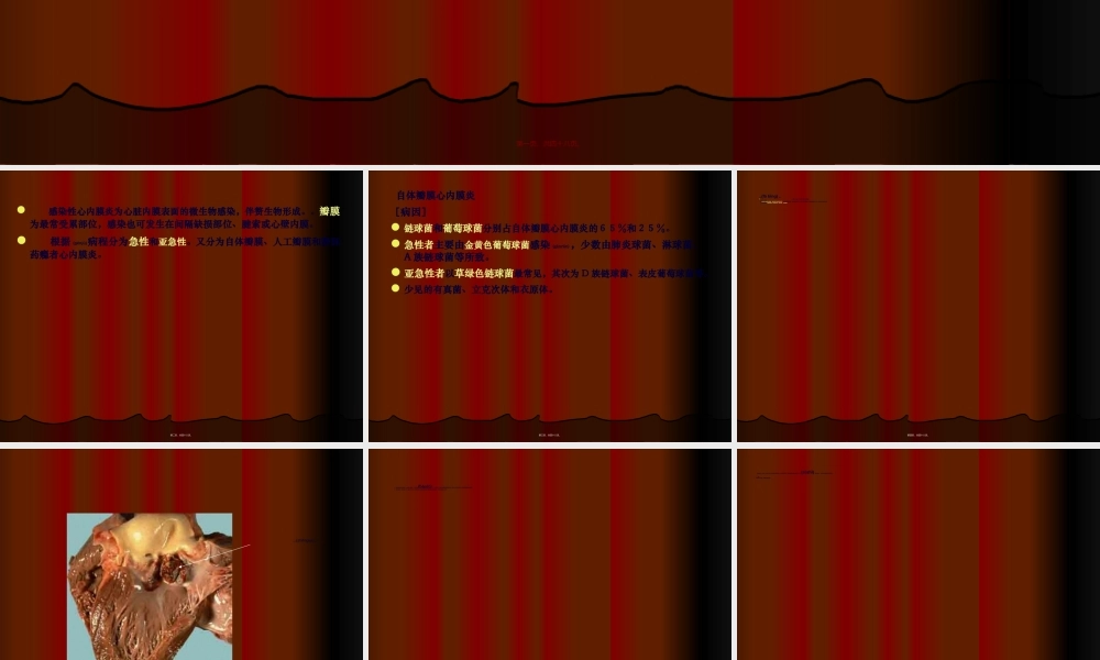 2022年医学专题—感染性心内膜炎心肌炎.ppt