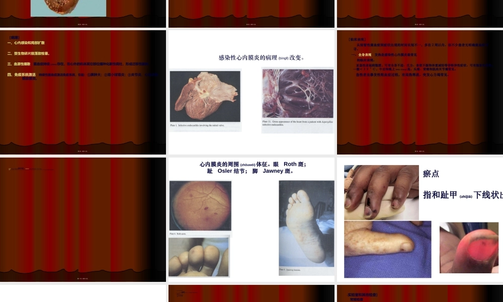 2022年医学专题—感染性心内膜炎心肌炎.ppt