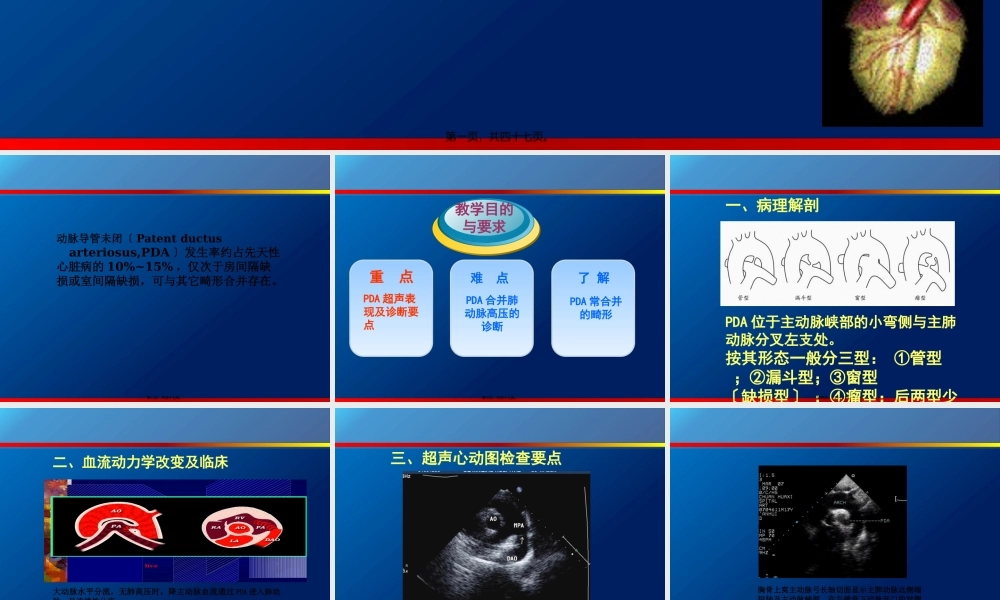 动脉导管未闭、主动脉狭窄.pptx