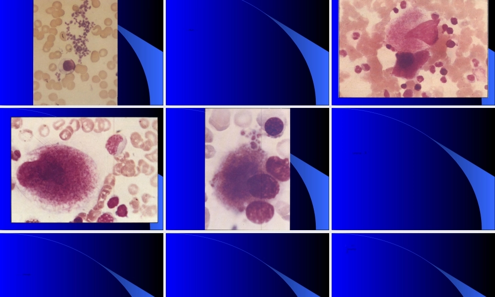 2022年医学专题—特-发-性-血-小-板-减-少.ppt