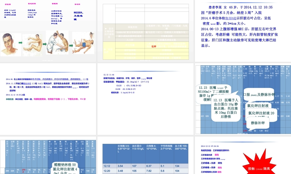 2022年医学专题—肝癌教学查房(1).ppt