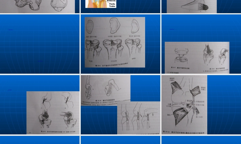 2022年医学专题—胡超华--膝关节运动创伤(1).ppt