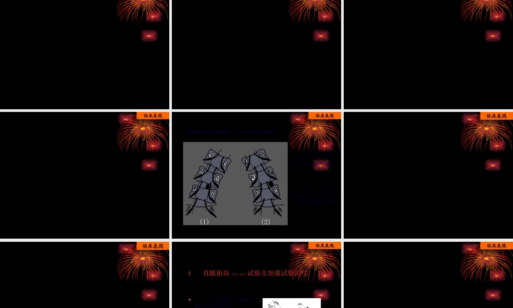 2022年医学专题—腰椎间盘突出症的诊治(1).ppt