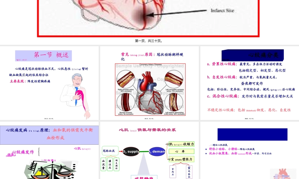 2022年医学专题—第28章-心绞痛.ppt