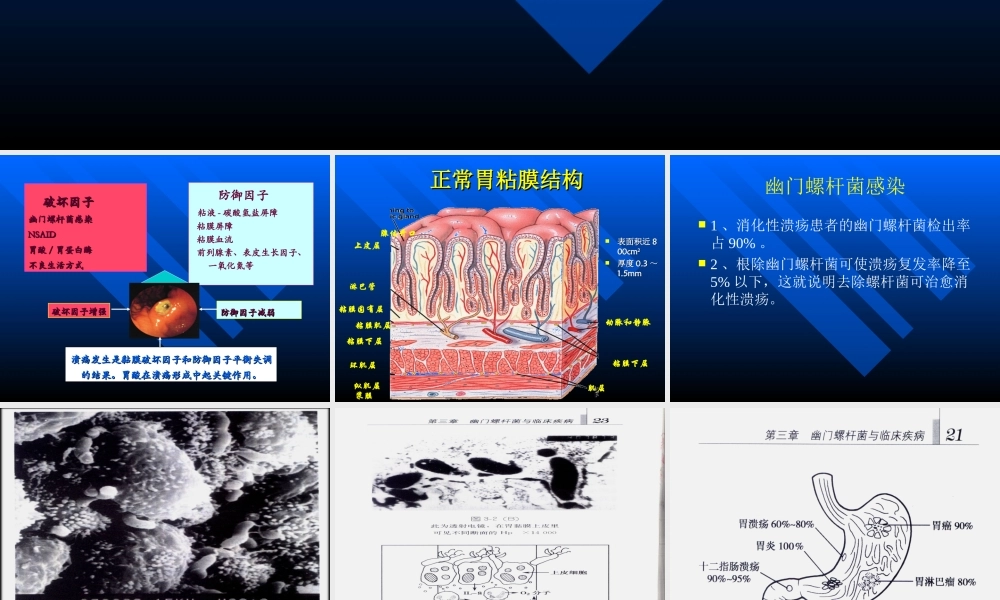 【药健康】浅述胃粘膜防御因子在消化性溃疡中的作用(1).ppt