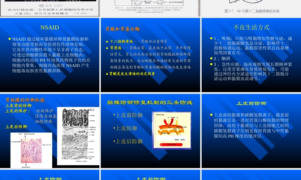 【药健康】浅述胃粘膜防御因子在消化性溃疡中的作用(1).ppt