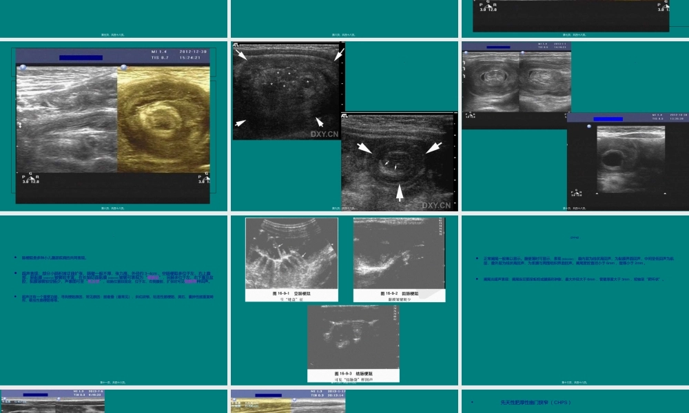 2022年医学专题—儿科急诊腹部超声.ppt