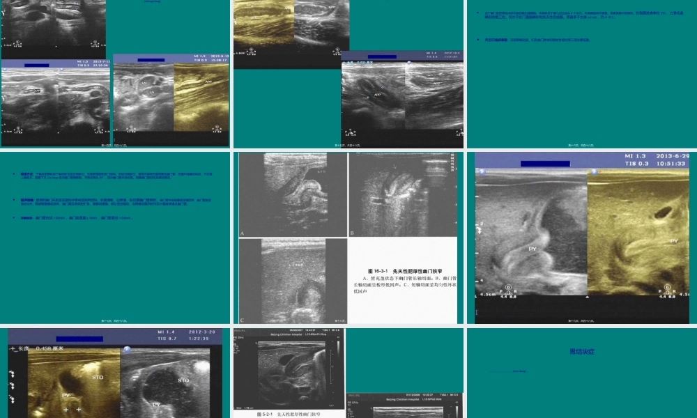 2022年医学专题—儿科急诊腹部超声.ppt