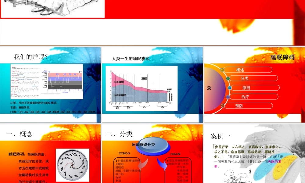 睡眠障碍ppt最终版.ppt