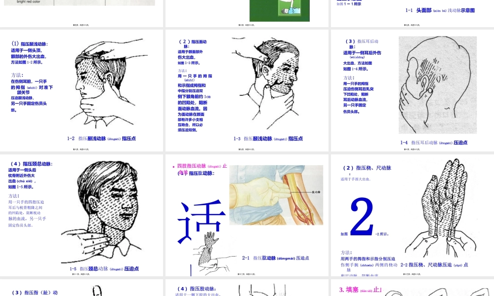 2022年医学专题—四种急救包扎训练资料20060920(1).ppt