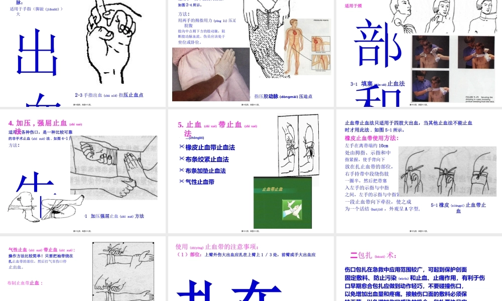 2022年医学专题—四种急救包扎训练资料20060920(1).ppt