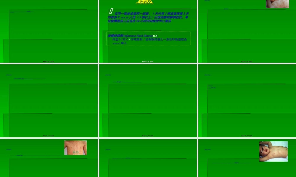 2022年医学专题—学校常见的呼吸道传染病及防控.(1).ppt