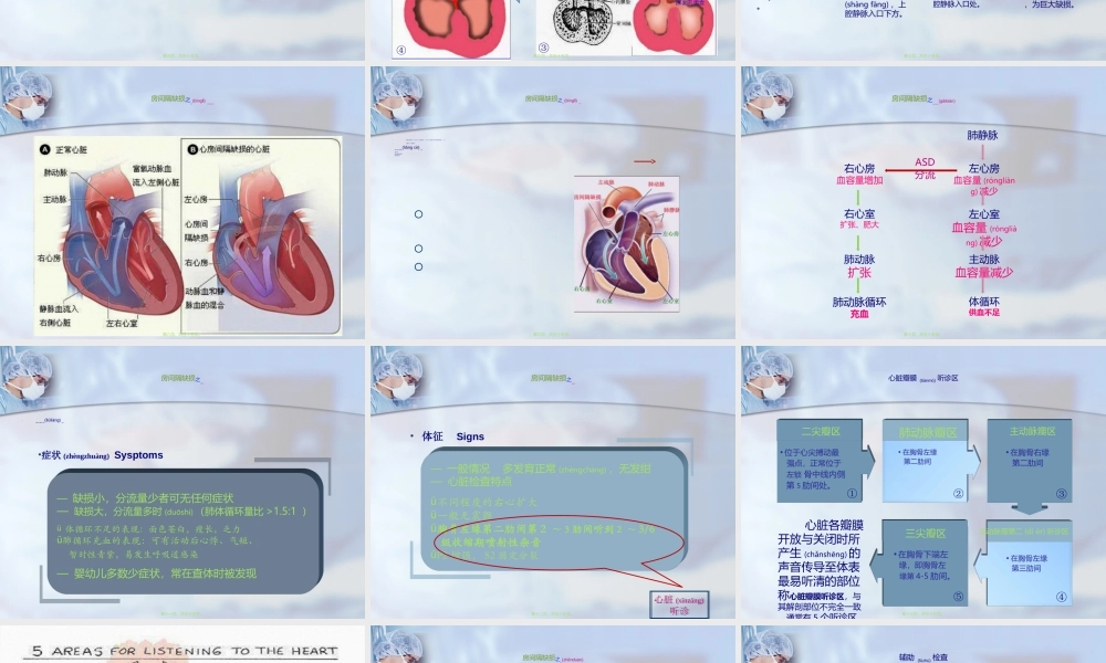 2022年医学专题—房间隔缺损业务查房.ppt