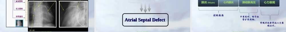 2022年医学专题—房间隔缺损业务查房.ppt