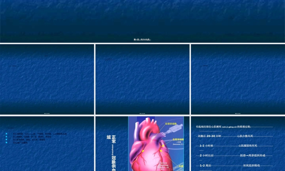 2022年医学专题—急性心肌梗死的诊疗进展(1).ppt