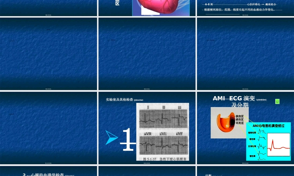 2022年医学专题—急性心肌梗死的诊疗进展(1).ppt