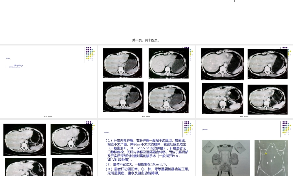 2022年医学专题—第七课：腹腔镜左肝外叶血管瘤切除术(1).ppt
