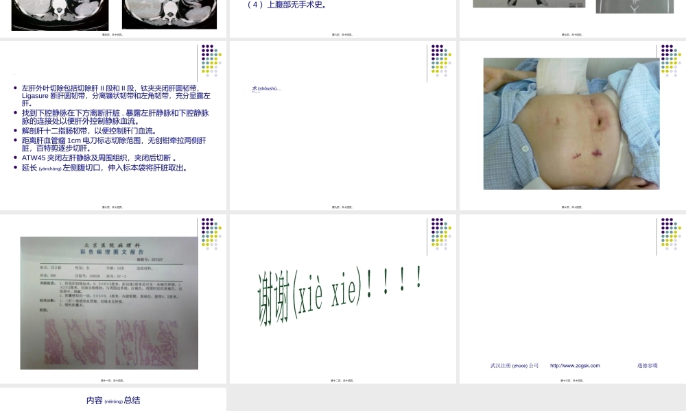 2022年医学专题—第七课：腹腔镜左肝外叶血管瘤切除术(1).ppt