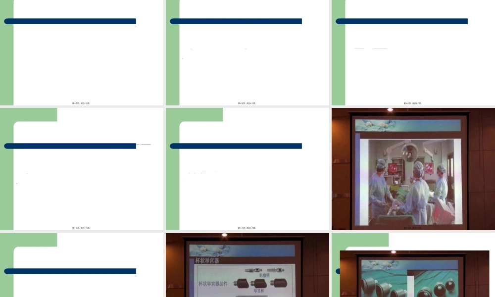 2022年医学专题—腹腔镜下全子宫切.ppt