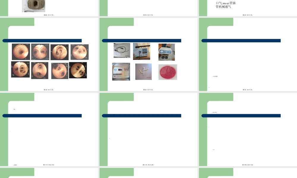2022年医学专题—纤维支气管镜在急危重症应用(1).ppt