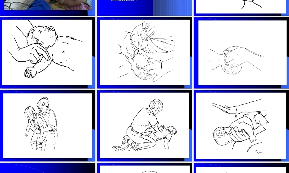 儿科急症的处理原则.pptx