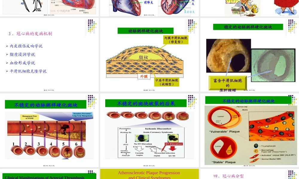 冠状动脉粥样硬化性.pptx